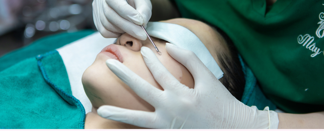 Điều Trị Mụn Chuẩn Y Khoa