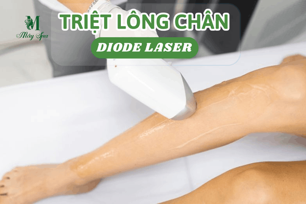 Khách hàng triệt lông chân hiệu quả với công nghệ Diode Laser