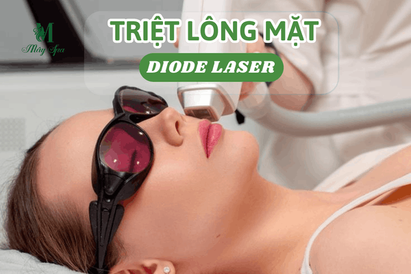Khách hàng triệt lông mặt hiệu quả với công nghệ Diode Laser