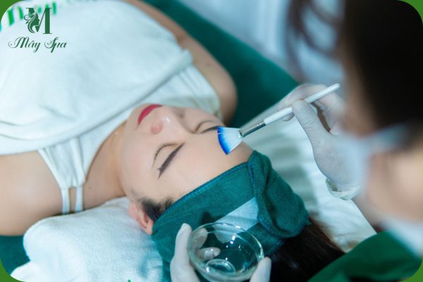 Quy trình peel da trị tàn nhang chuẩn y khoa với chuyên viên tại Mây Spa Tân Phú