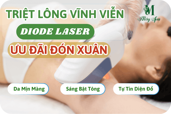 Triệt lông công nghệ Diode Laser hiện đại