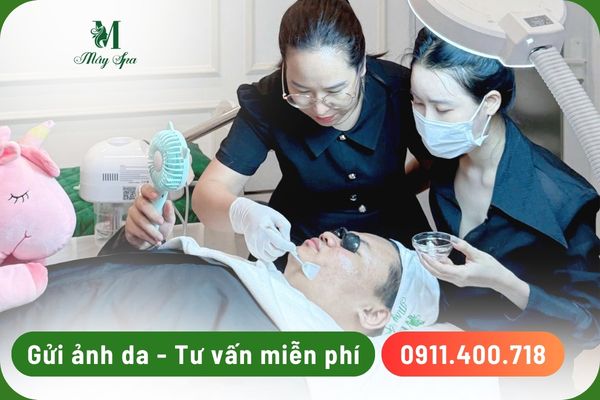 Tư vấn peel da trị tàn nhang miễn phí tại Mây Spa Tân Phú