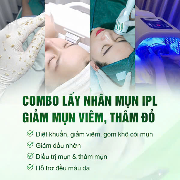 Công dụng của việc bắn IPL trong việc xử lý mụn viêm, giảm thâm đỏ