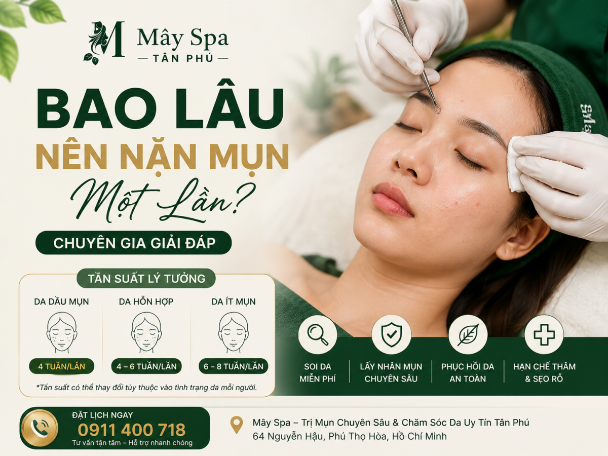 Bao l&acirc;u n&ecirc;n nặn mụn một lần