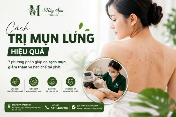 Điều trị mụn lưng chuẩn y khoa tại M&acirc;y Spa T&acirc;n Ph&uacute;