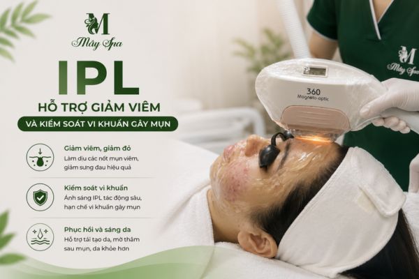 IPL hỗ trợ giảm viêm và kiểm soát vi khuẩn gây mụn