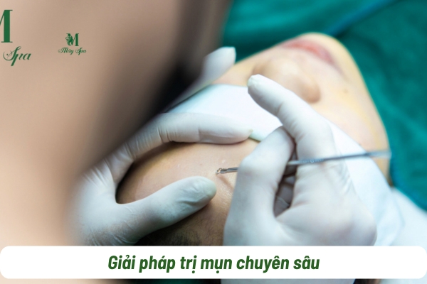 Quy tr&igrave;nh trị mụn chuẩn y khoa