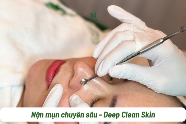 Nặn mụn kh&ocirc;ng đau tại M&acirc;y spa T&acirc;n Ph&uacute;