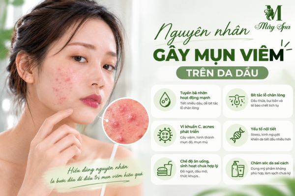 Nguyên nhân da dầu dễ bị mụn viêm do bít tắc lỗ chân lông