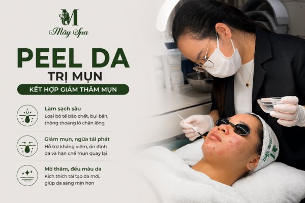 Peel da trị mụn giúp làm sạch lỗ chân lông và giảm thâm