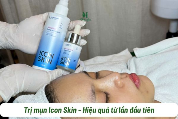 Liệu trình trị mụn hiệu quả Icon Skin 18%