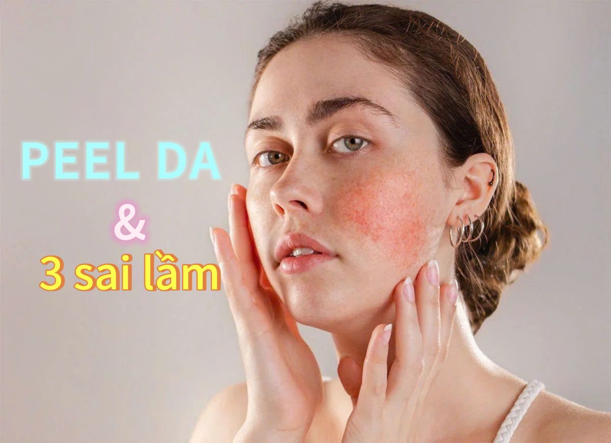 3 sai lầm khiến da càng peel càng xấu