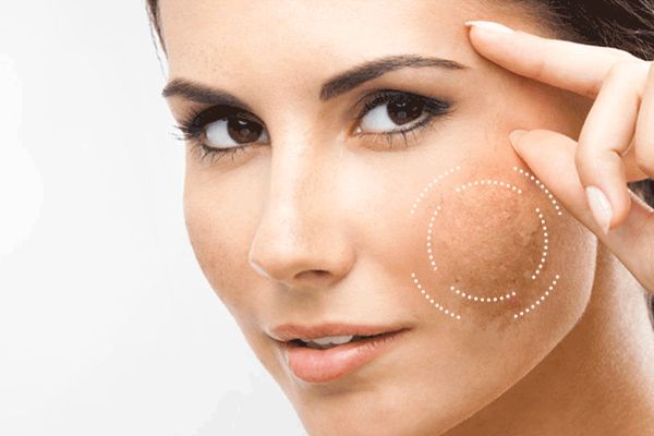5 dấu hiệu cho biết da cần được Peel ngay