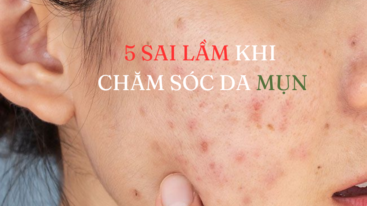 5 sai lầm phổ biến khi chăm sóc da mụn