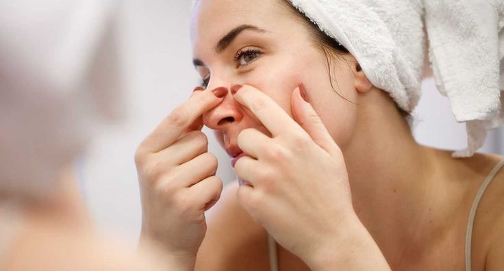 Chăm sóc da sau khi lấy nhân mụn để tránh thâm sẹo