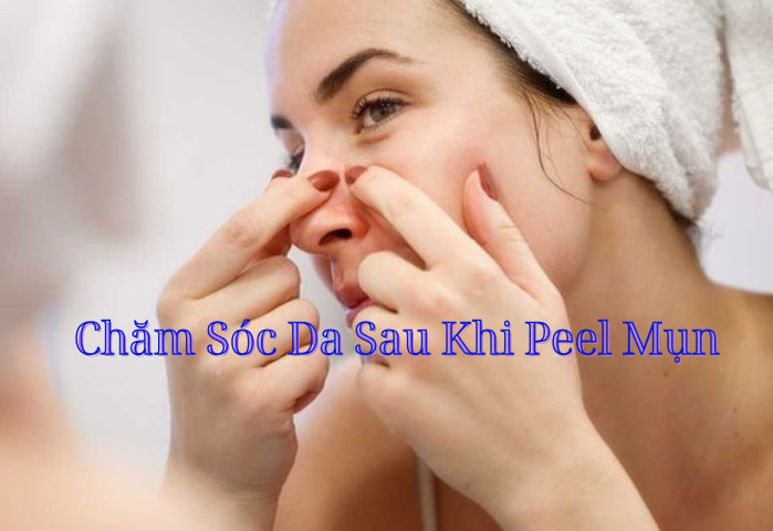 Chăm sóc da đúng cách sau khi Peel mụn sẽ giúp đẩy nhanh quá trình điều trị mụn