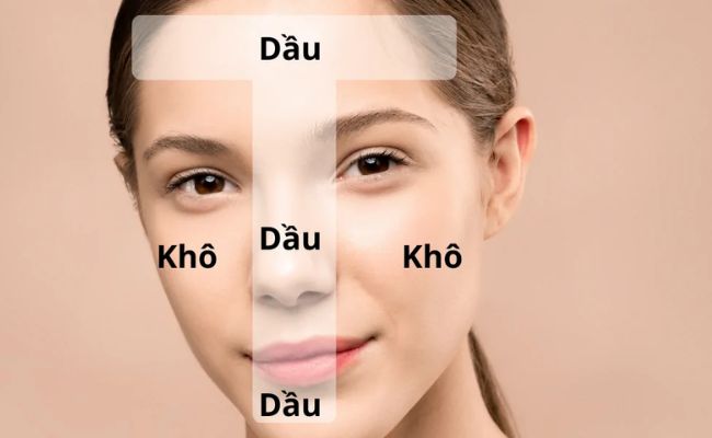 Da hỗn hợp