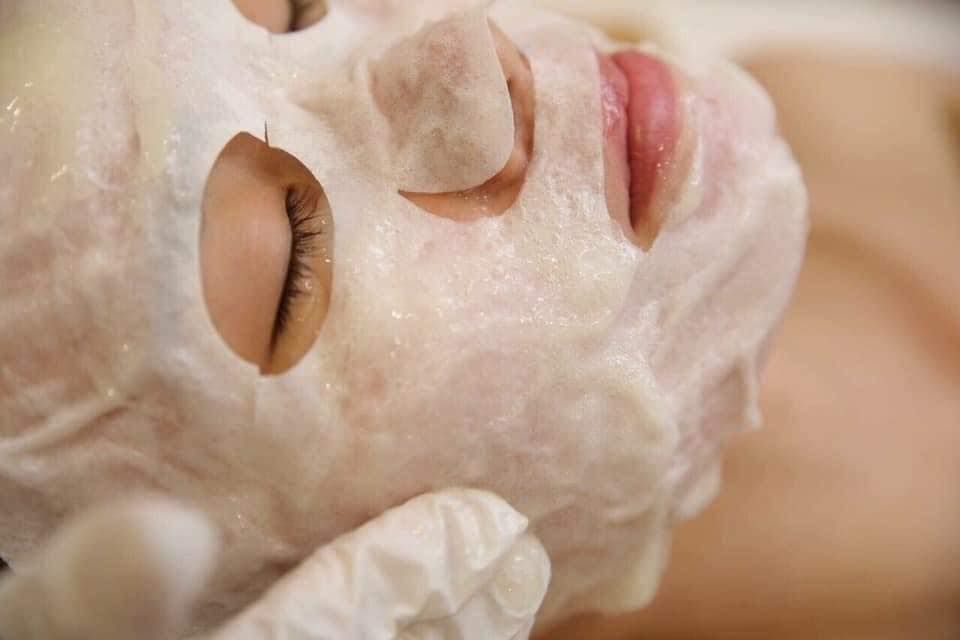 Detox co2 cải thiện đáng kể triệu chứng mụn