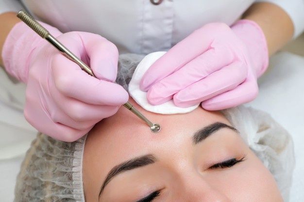 Lấy nhân mụn là 1 bước quan trọng trong việc chăm sóc da