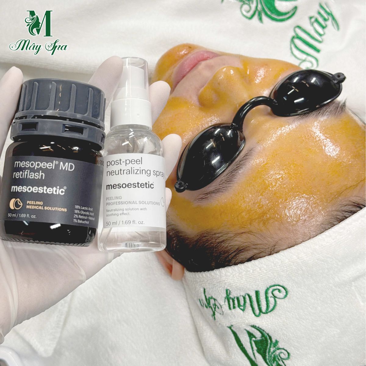 Mesopeel - Giải pháp peel da chuyên sâu