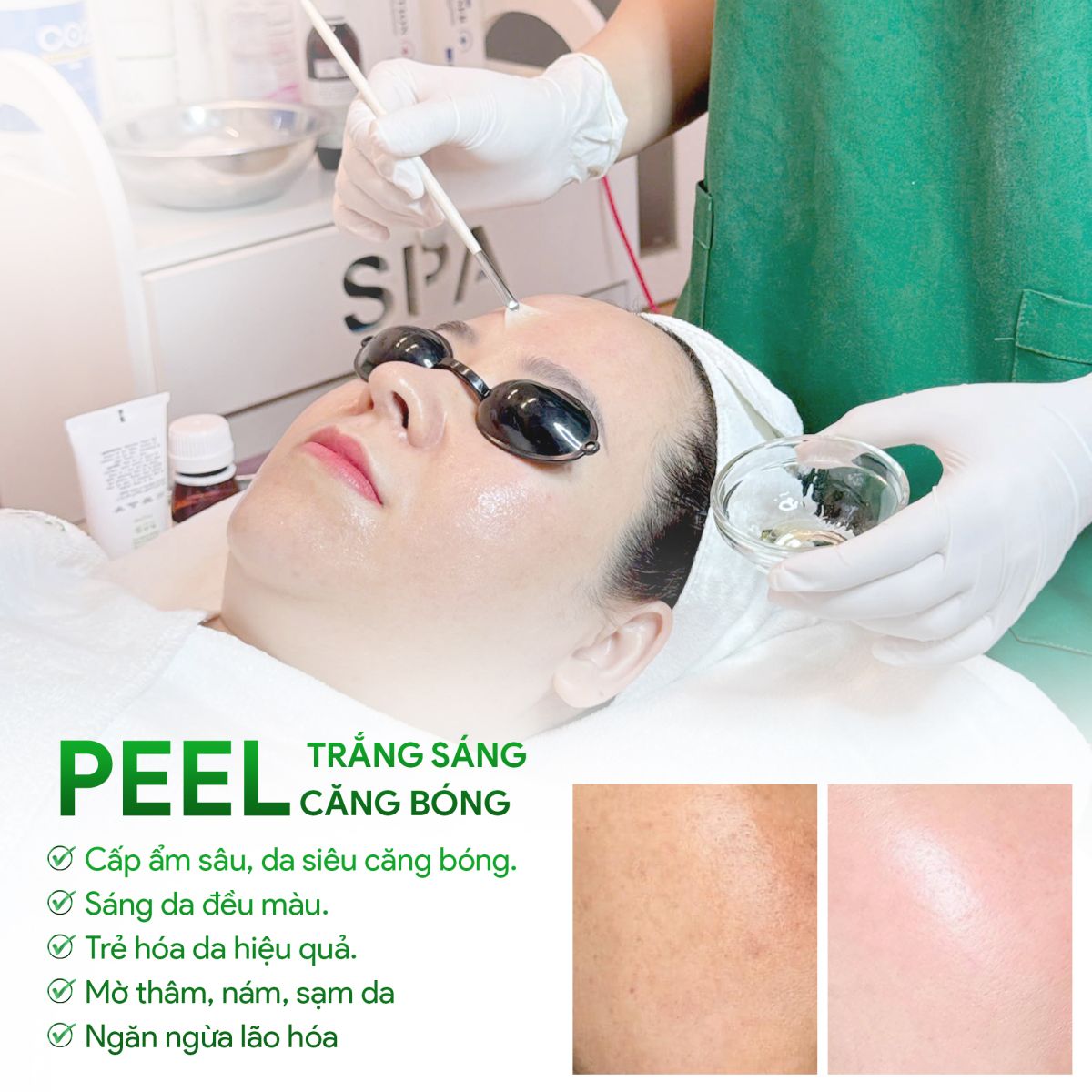 Liệu trình peel da trắng sáng, căng bóng sử dụng dược mỹ phẩm cao cấp từ Châu Âu