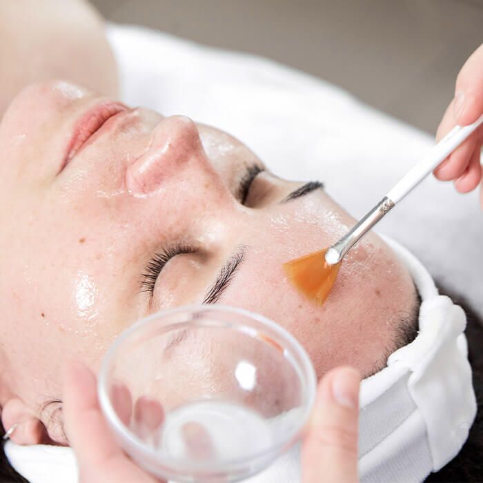 Peel da là phương pháp trị mụn chuẩn y khoa rất hiệu quả