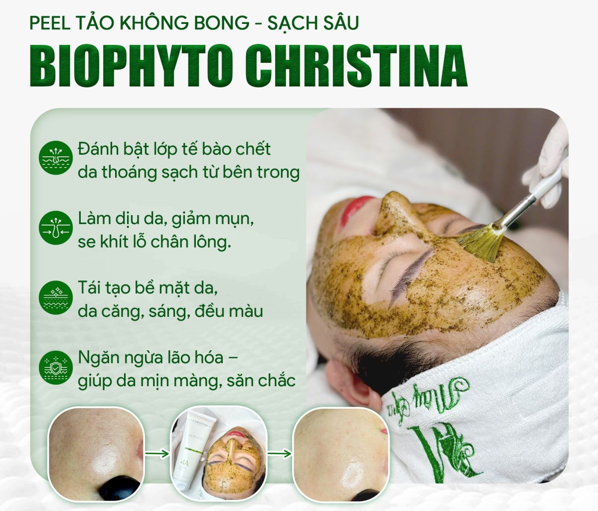 Peel tảo Biophyto không bong