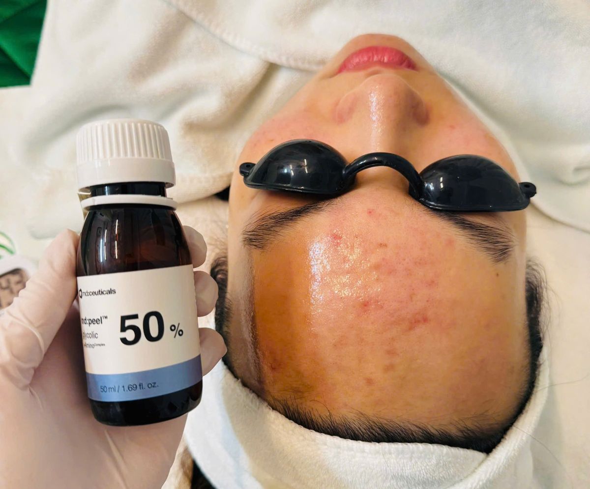 M&acirc;y spa T&acirc;n Ph&uacute; lu&ocirc;n sử dụng Dược Mỹ Phẩm ch&iacute;nh h&atilde;ng cao cấp trong qu&aacute; tr&igrave;nh điều trị mụn