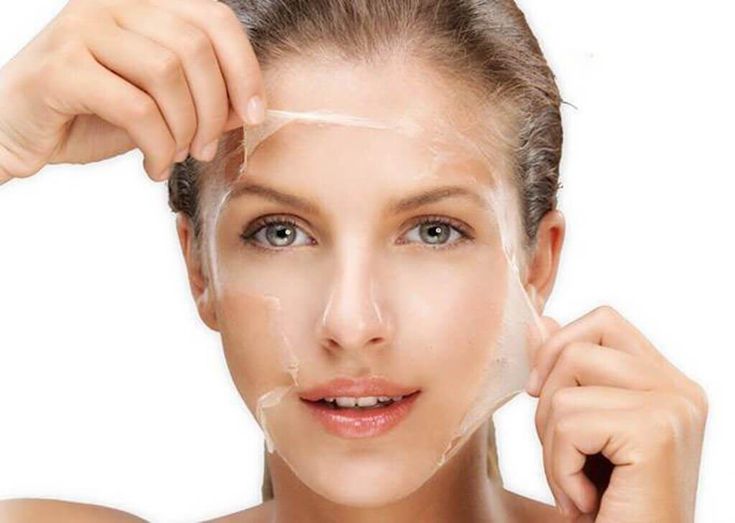 Lựa chọn liệu trình Peel da chuẩn y khoa đảm bảo an toàn, hiệu quả, tiết kiệm trong việc điều trị mụn