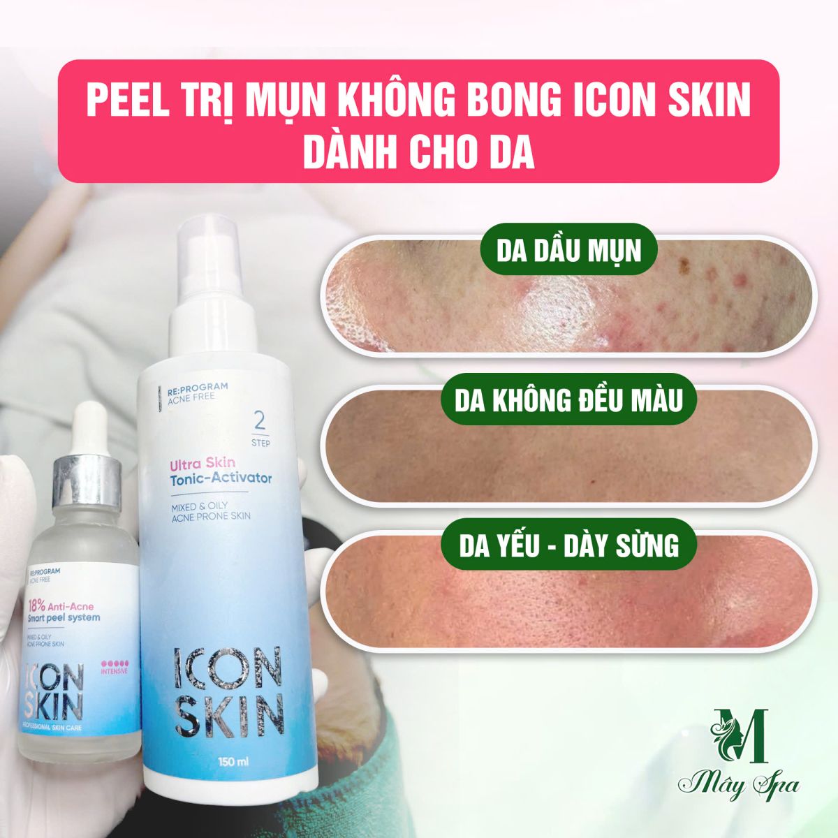 Công dụng của nặn mụn tiêu khuẩn Icon Skin