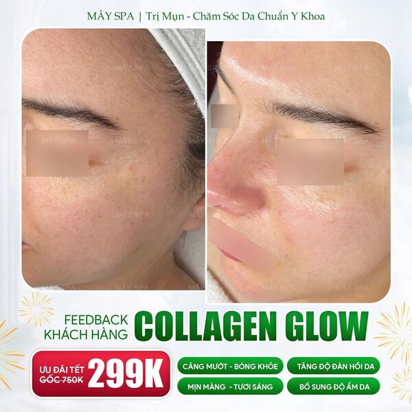 Feed back liệu trình chăm sóc da tại Mây spa Tân Phú