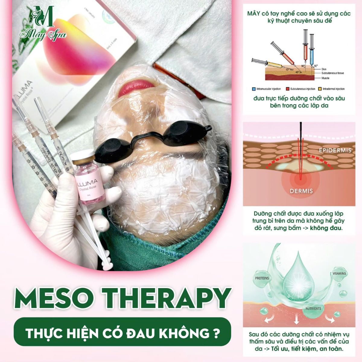 tiêm meso có đau không