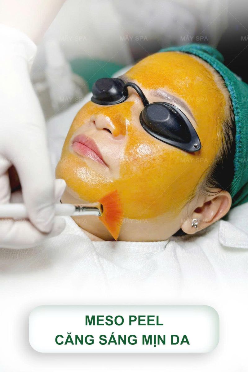 Mesopeel l&agrave; g&igrave; v&agrave; khi n&agrave;o n&ecirc;n thực hiện mesopeel ?