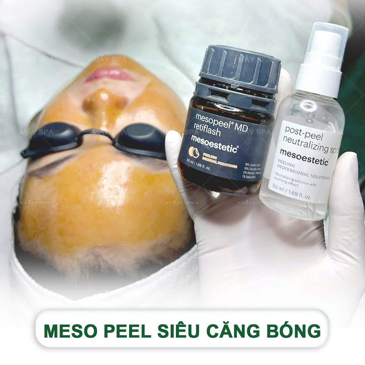 Mesopeel - Trắng s&aacute;ng,căng b&oacute;ng da an to&agrave;n