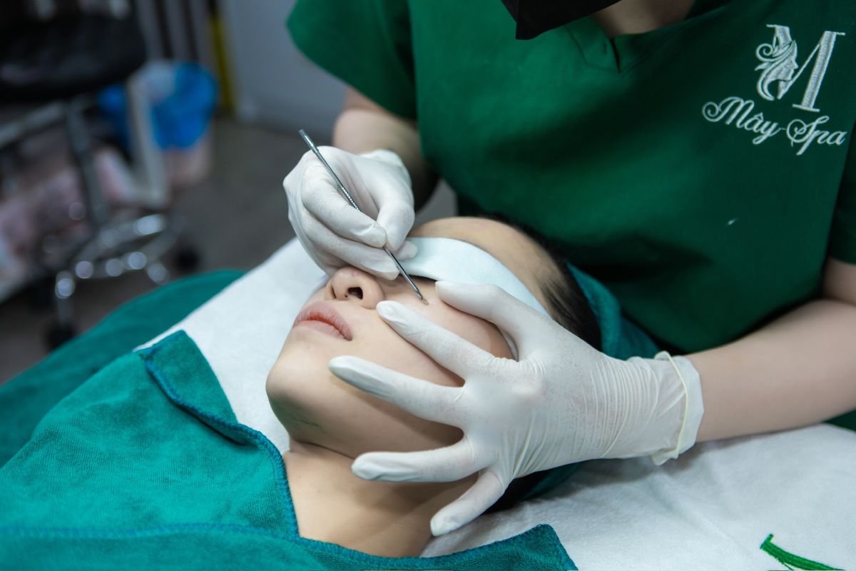 Nặn mụn chuẩn y khoa giá sinh viên