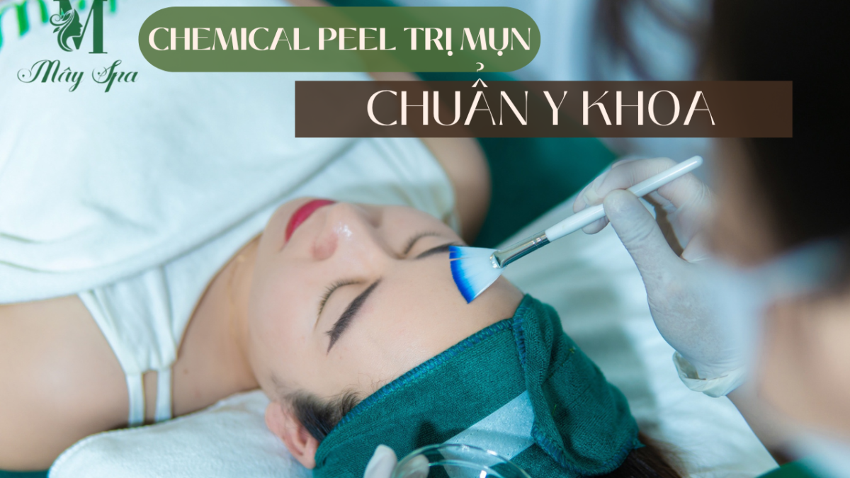 Chemical peel trị mụn - thanh lọc da từ gốc