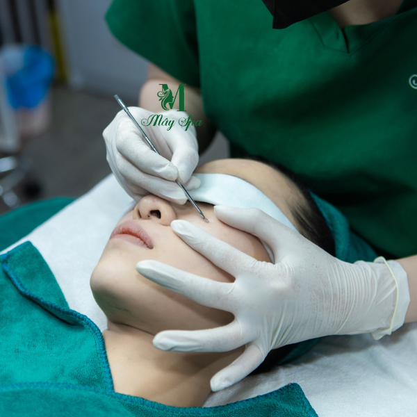 Spa nặn mụn chuẩn y khoa uy tín tại Bình Thạnh