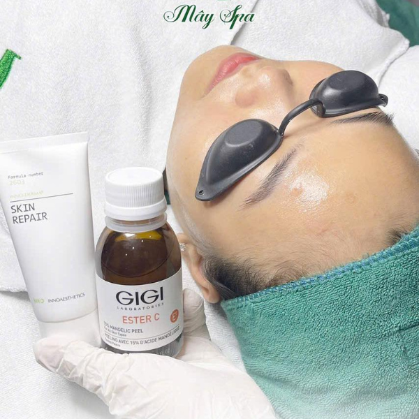 Peel da trị mụn bằng dược mỹ phẩm rất an toàn