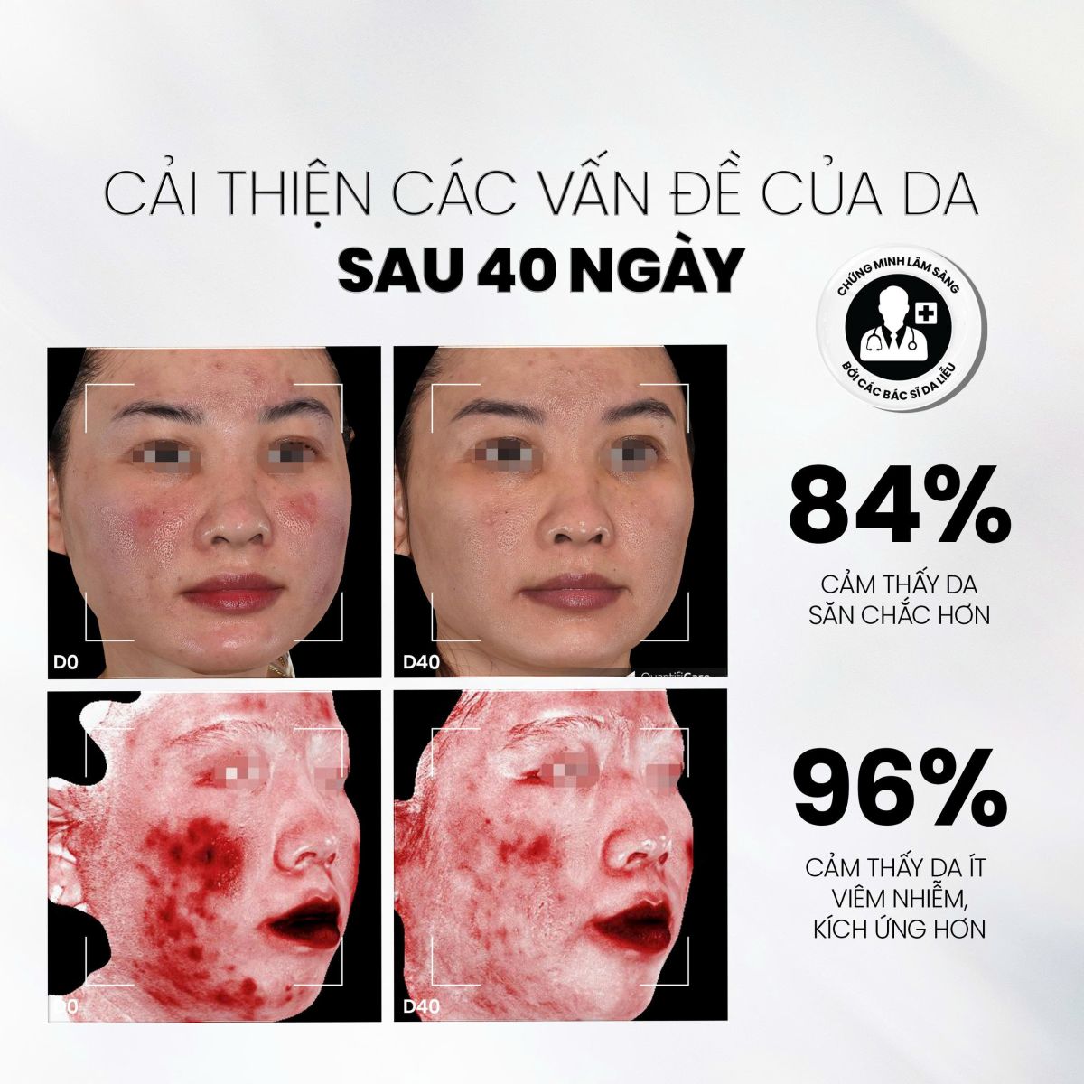 Serum NMF Prebiotics luôn được tin tưởng sử dụng trong Routine bôi thoa tại nhà