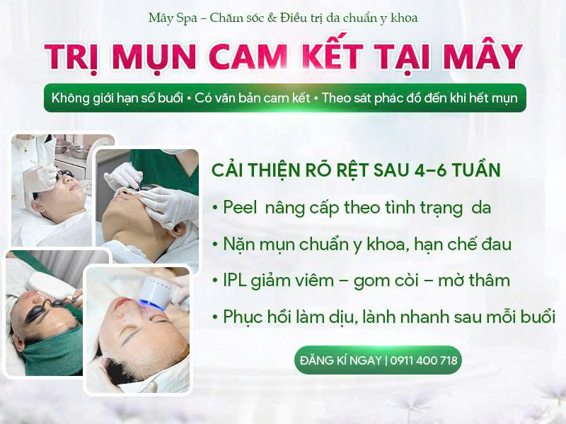 Trị dứt điểm mụn, cam kết bằng văn bản tại M&acirc;y spa T&acirc;n Ph&uacute;