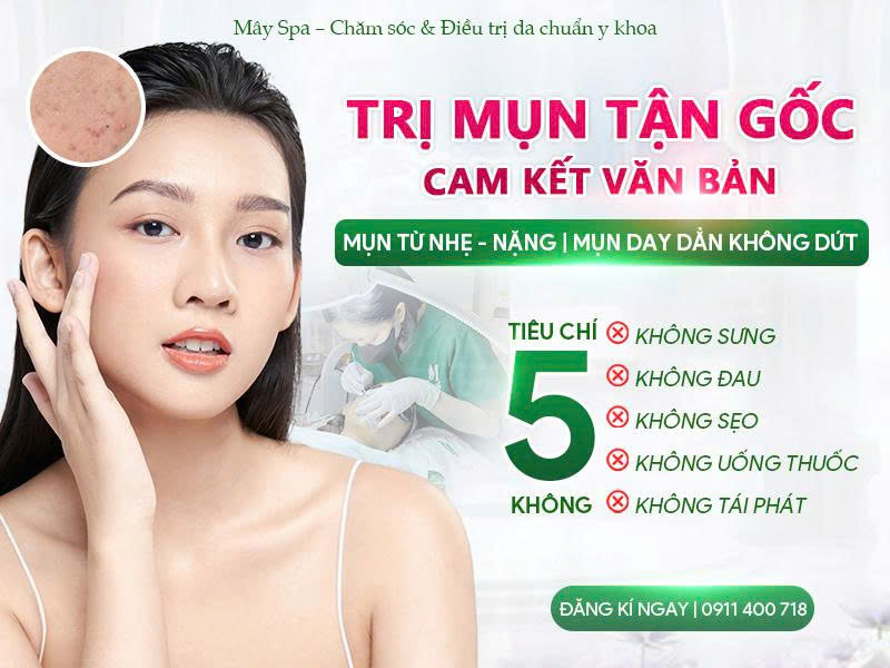 Trị mụn dứt điểm an to&agrave;n v&agrave; chuẩn y khoa tại M&acirc;y spa T&acirc;n Ph&uacute;