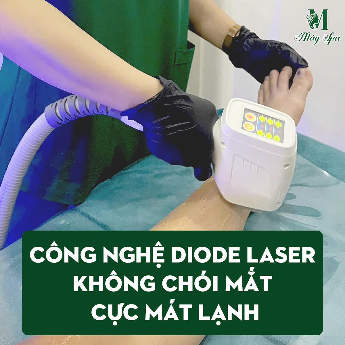 Công nghệ Diod Lazer tiên tiến mát lạnh,không đau rát