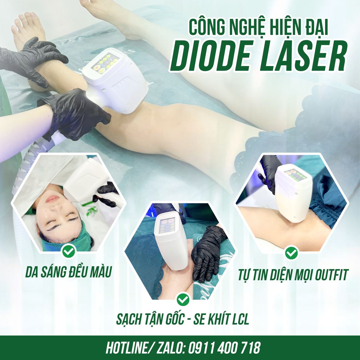 Spa Tân Phú - Mây spa - Triệt lông công nghệ Diode Laser an toàn, hiệu quả