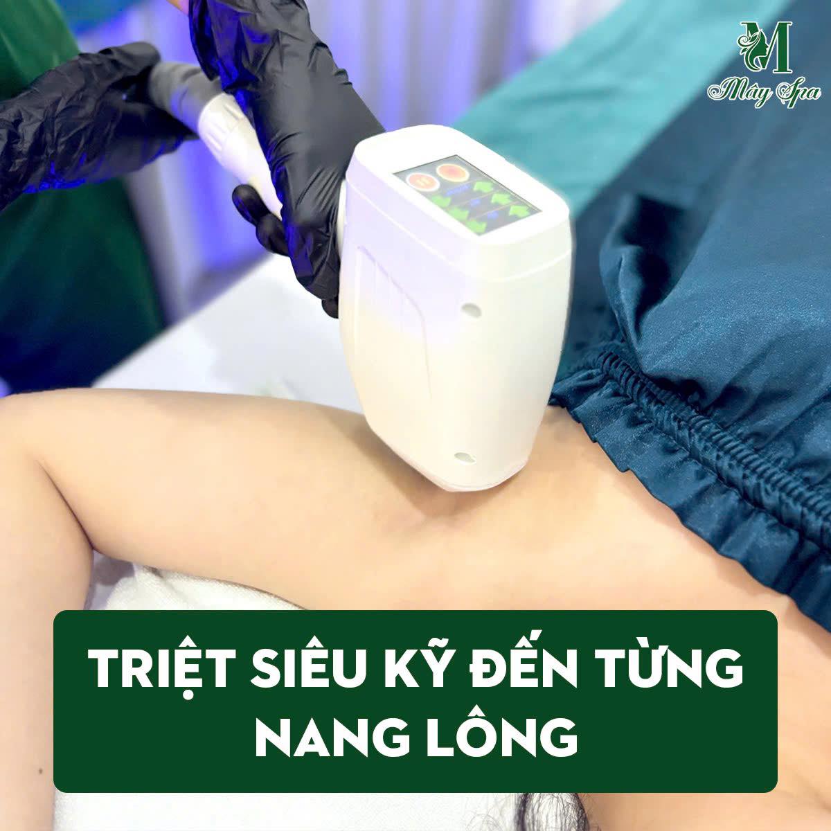 Công nghệ Diod Lazer xử lý đến từng nang lông