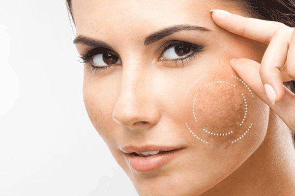 5 dấu hiệu cho thấy bạn cần peel da ngay!