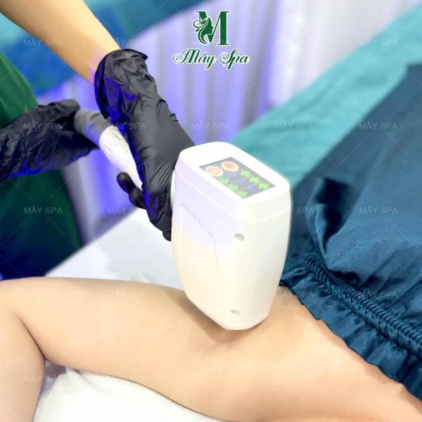 Địa chỉ spa triệt lông Diode Laser uy tín tại quận Tân Phú – Mây Spa
