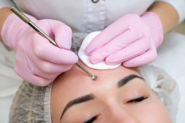 Bao Lâu Nên Đi Lấy Nhân Mụn Bao Lâu Nên Đi Lấy Nhân Mụn