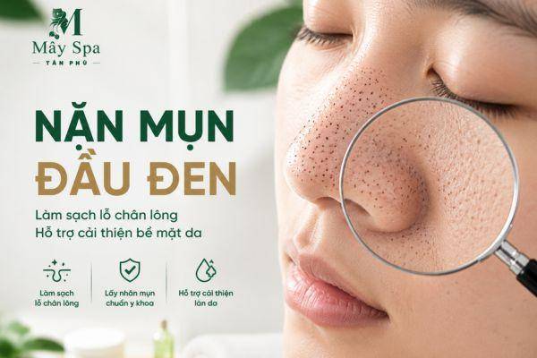 Nặn Mụn Đầu Đen An Toàn – Giải Pháp Làm Sạch Lỗ Chân Lông Và Hạn Chế Mụn Tái Phát