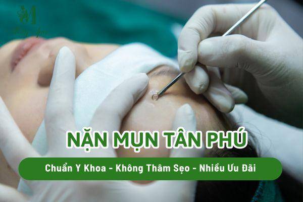 Nặn Mụn Tân Phú Chuẩn Y Khoa