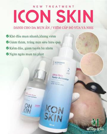Nặn mụn tiêu khuẩn Icon Skin – Liệu trình trị mụn y khoa an toàn | Mây Spa